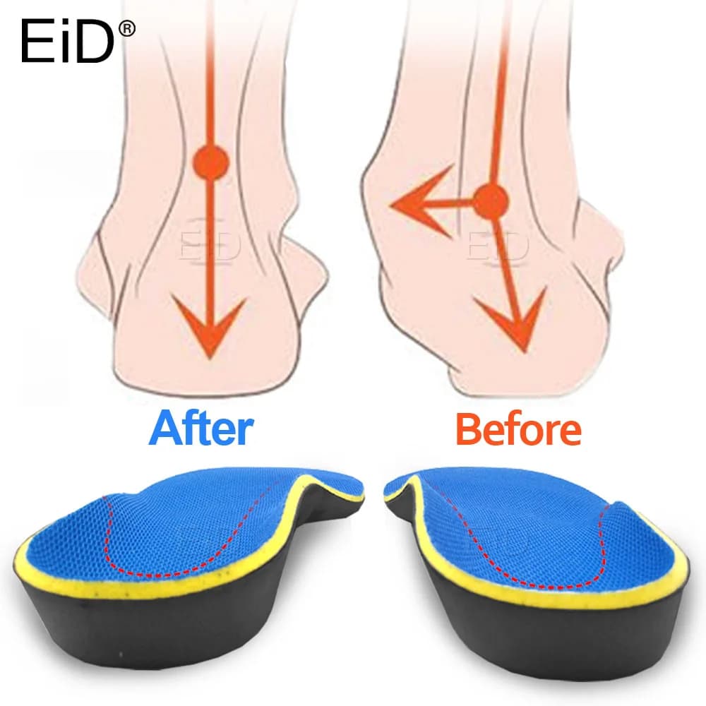 Eid palmilhas ortopédicas 3d, pés planos, suporte de arco, inserções ortopédicas, fascite plantar, pias, pronação de dor para homens, mulheres, unissex
